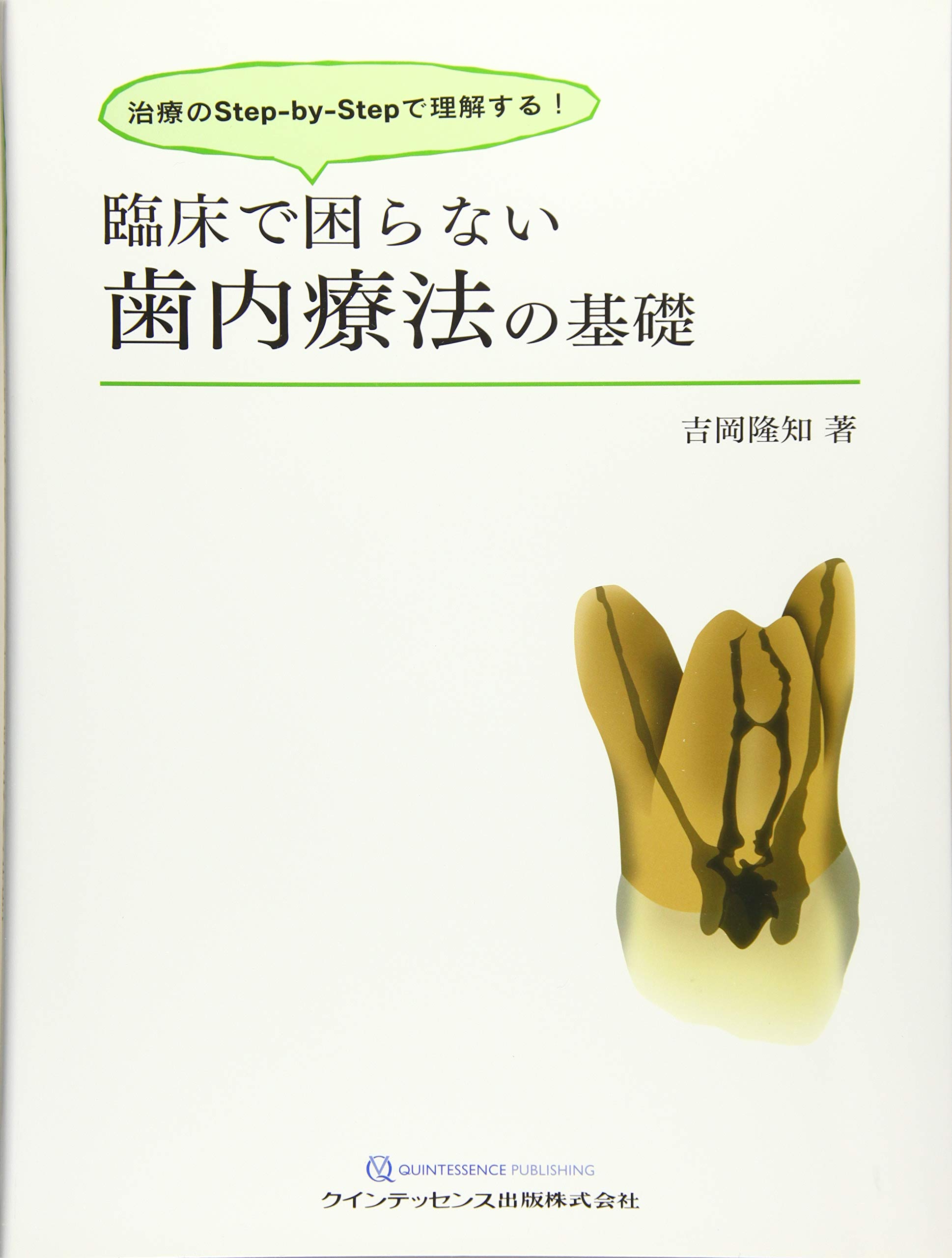 臨床で困らない歯内療法の基礎 | 吉岡 隆知 |本 | 通販 | Amazon