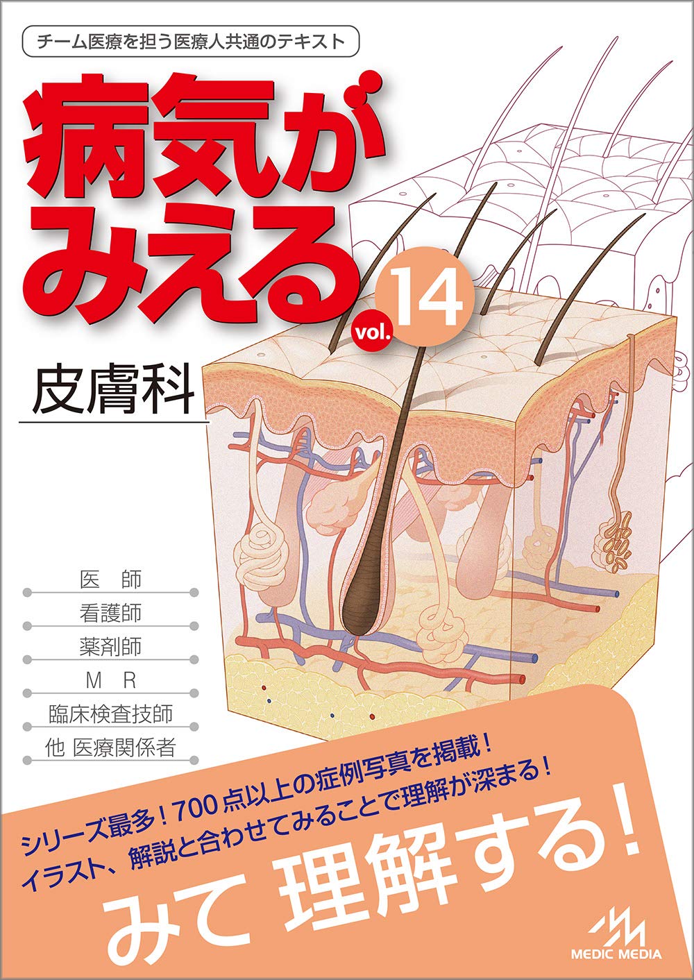 Amazon.co.jp: 病気がみえる vol.14 皮膚科 第1版 : 医療情報科学研究