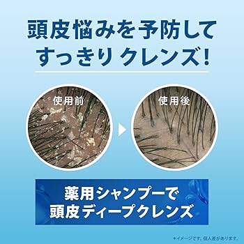 Amazon.co.jp: h&s シャンプー&コンディショナー 2.2L+2.2KG [7 個分+7