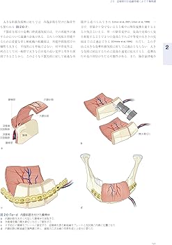 AO法骨折治療 アドバンスト頭蓋顎顔面手術: 腫瘍、骨矯正、外傷 | 下郷