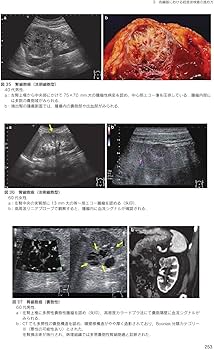 日超検 腹部超音波テキスト第3版 | 日本超音波検査学会, 南里 和秀
