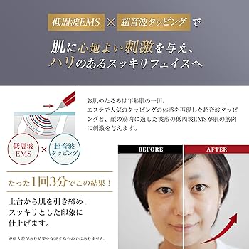 Amazon.co.jp: 【公式】roserine Dr.'s esthetics アクアリフト