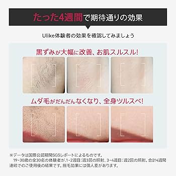 Amazon | Ulike ユーライク 脱毛器 Air メンズ レディース VIO対応