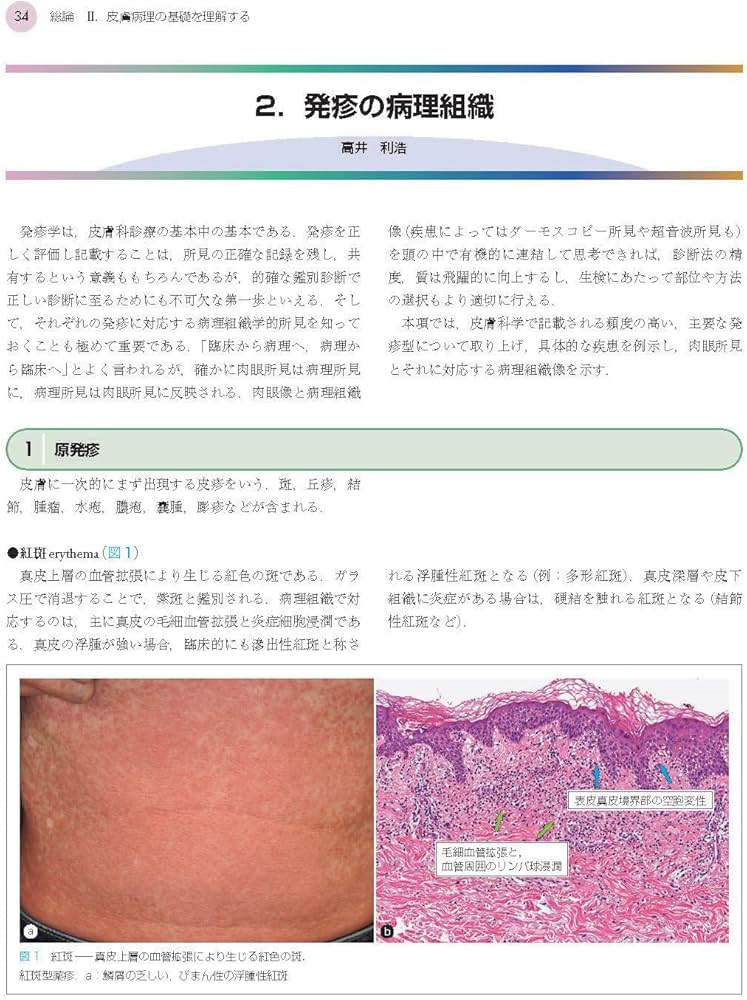 皮膚病理組織診断学入門 裁断済みです 楽天市場】皮膚病理組織診断学