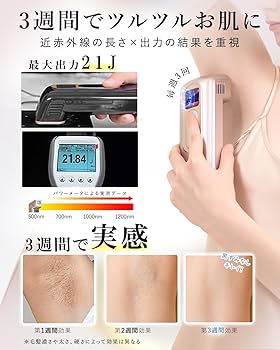 Amazon | 脱毛器 最大出力21J 無痛脱毛器 冷却機能付き だつもうき脱毛