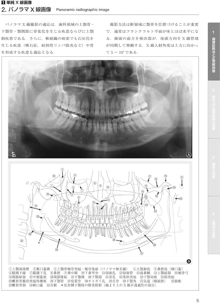 歯科臨床における画像診断アトラス 第2版 | 日本歯科放射線学会 |本