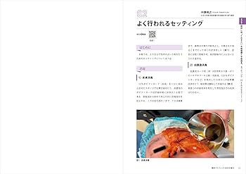 網膜硝子体手術：基本と応用，トラブル＆リカバリーがわかる！ (眼科