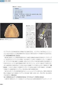 よくわかる口腔インプラント学 第4版 | 赤川 安正, 細川 隆司, 横山