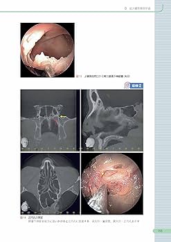 71p0iq20ZcL._AC_UF350,