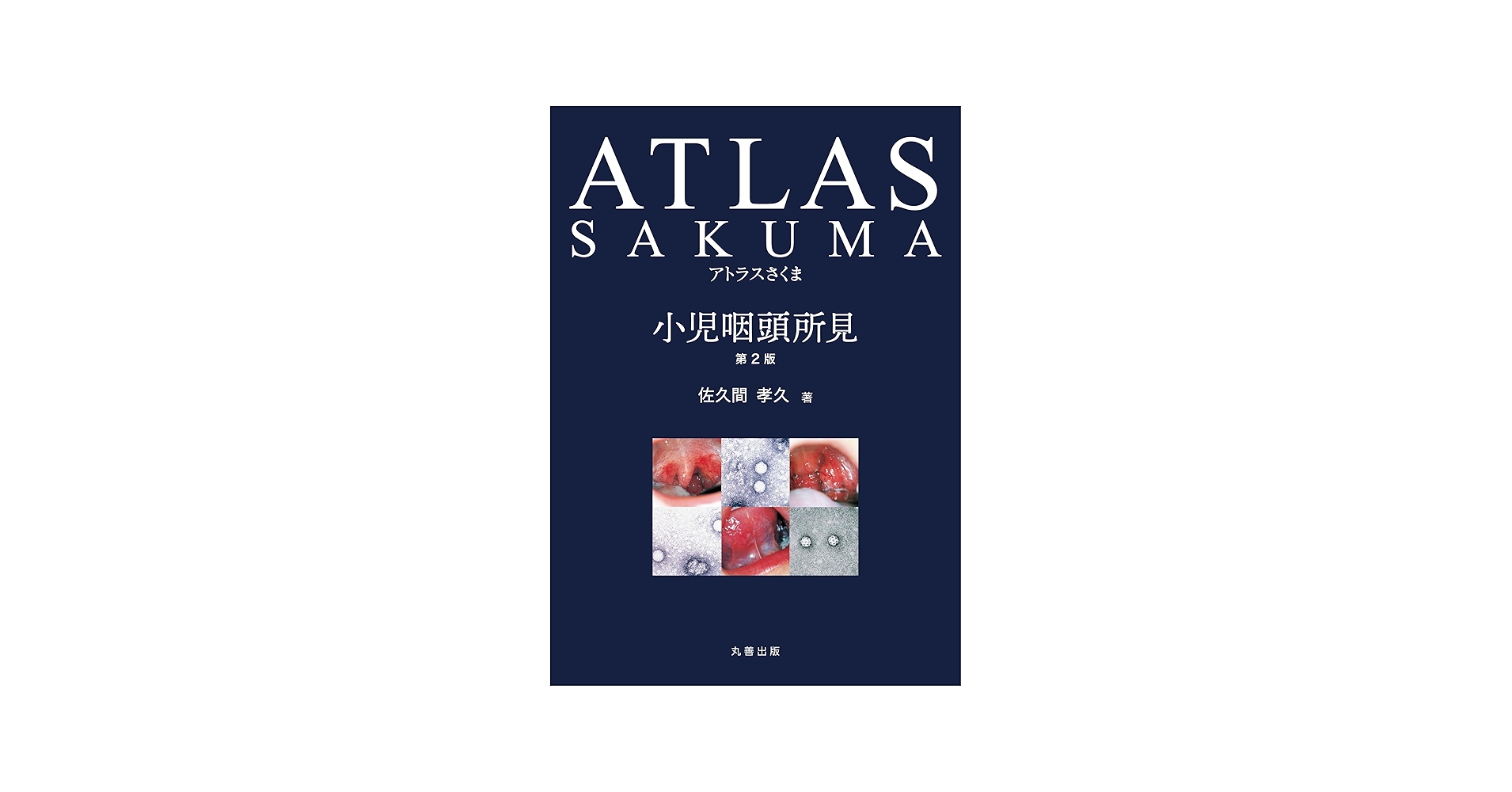 Amazon.co.jp: アトラスさくま 小児咽頭所見 第2版 : 佐久間 孝久: 本