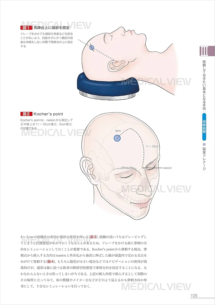 脳神経外科 ザ・ベーシック | 大宅 宗一 |本 | 通販 | Amazon