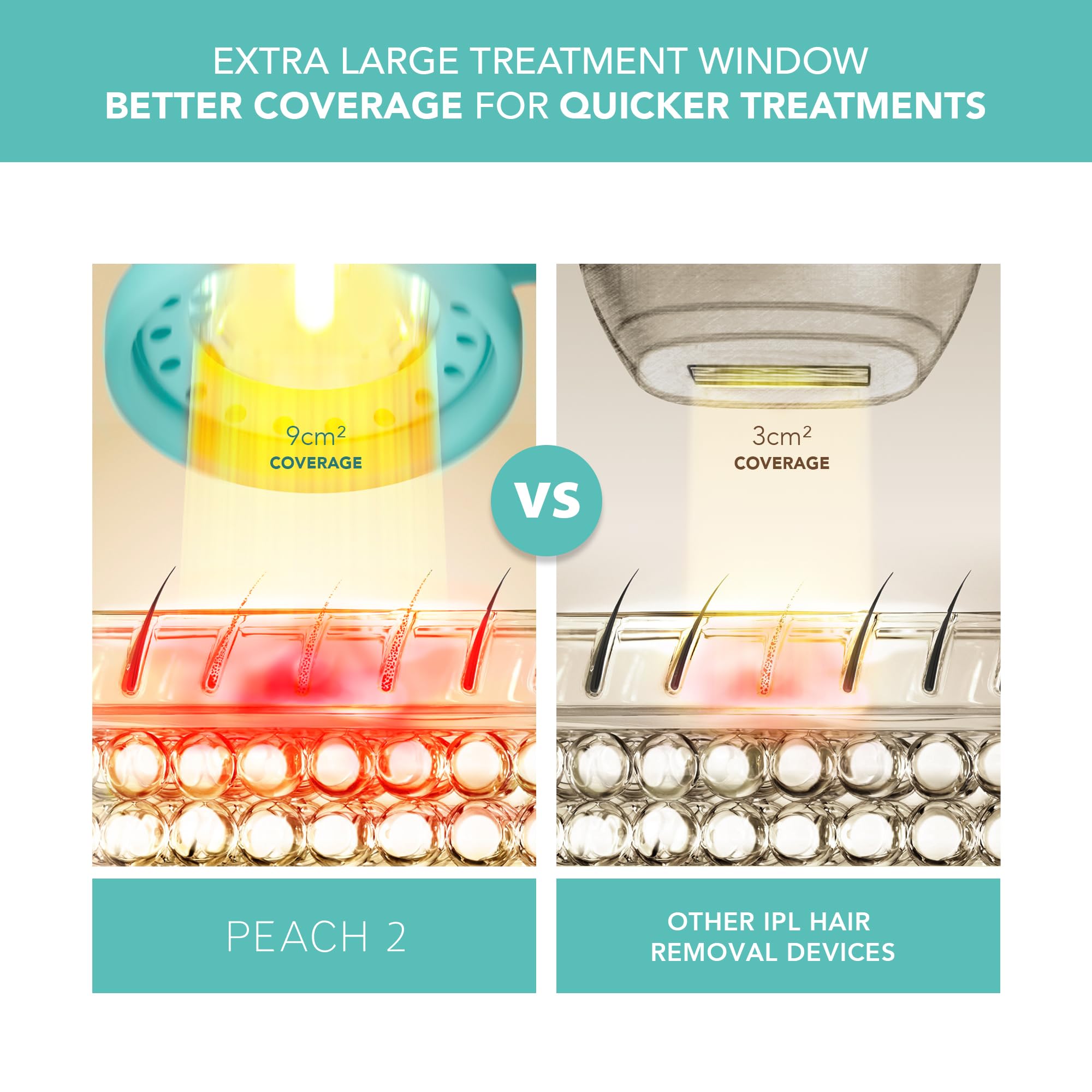 Amazon.com: FOREO Peach 2 IPL Hair Removal Device – Quick & Gentle