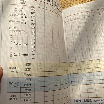 Amazon.co.jp: 高血圧管理手帳 グラフ記入式 血圧手帳 日本高血圧協会
