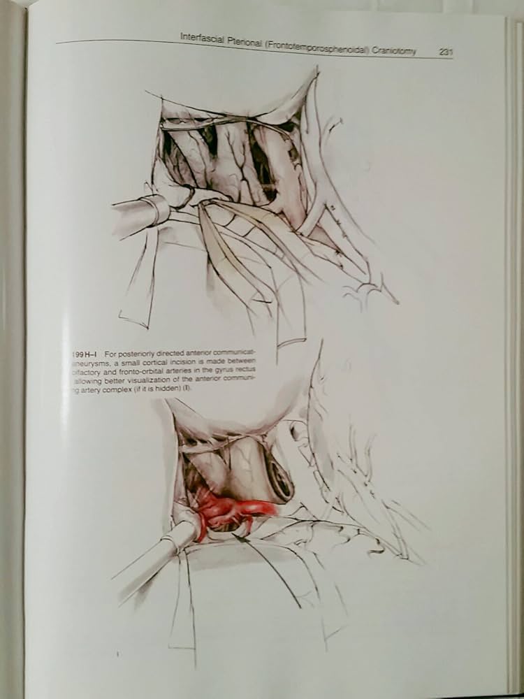 Microneurosurgery: 9780865771413: Medicine & Health Science Books