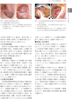 Amazon.co.jp: 今日の耳鼻咽喉科・頭頸部外科治療指針 第4版 : 森山 寛: 本