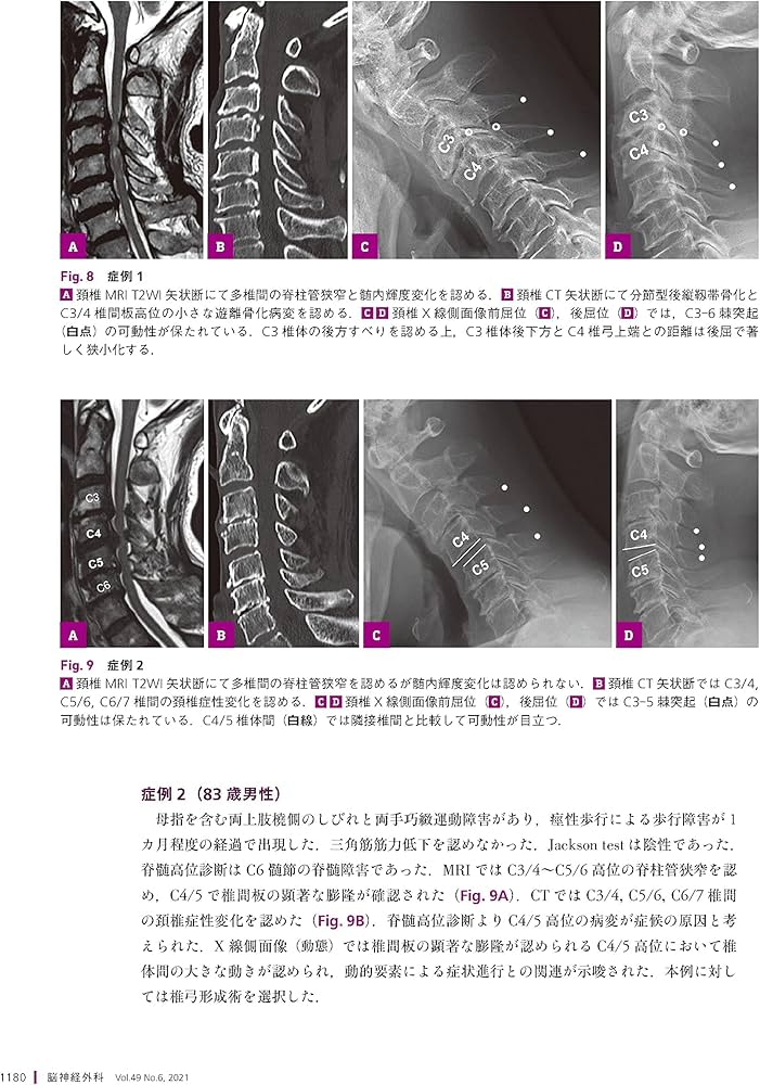 脳神経外科 Vol.49 No.6 脊髄脊椎・末梢神経外科ことはじめ | 竹島