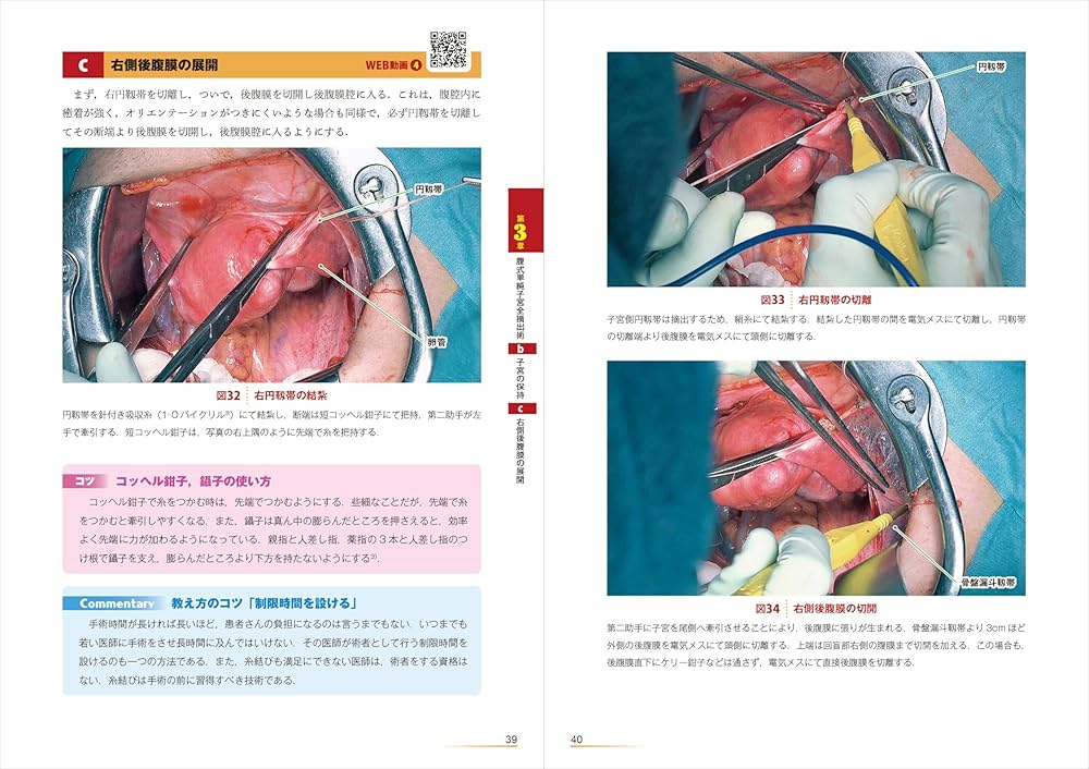 Amazon.co.jp: 改訂2版 腹式単純子宮全摘出術： 開腹から広汎子宮全