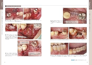 8112F1uTlmL._AC_UF350,