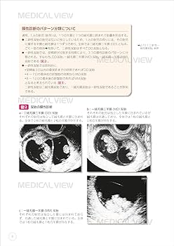 811aw7q5lqL._AC_UF350,