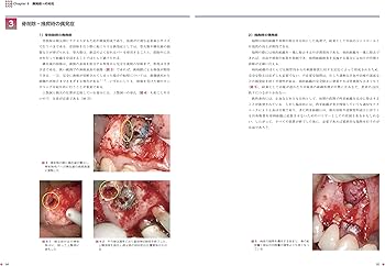 世界基準の臨床歯内療法2 外科的歯内療法 マイクロスコープを用いた