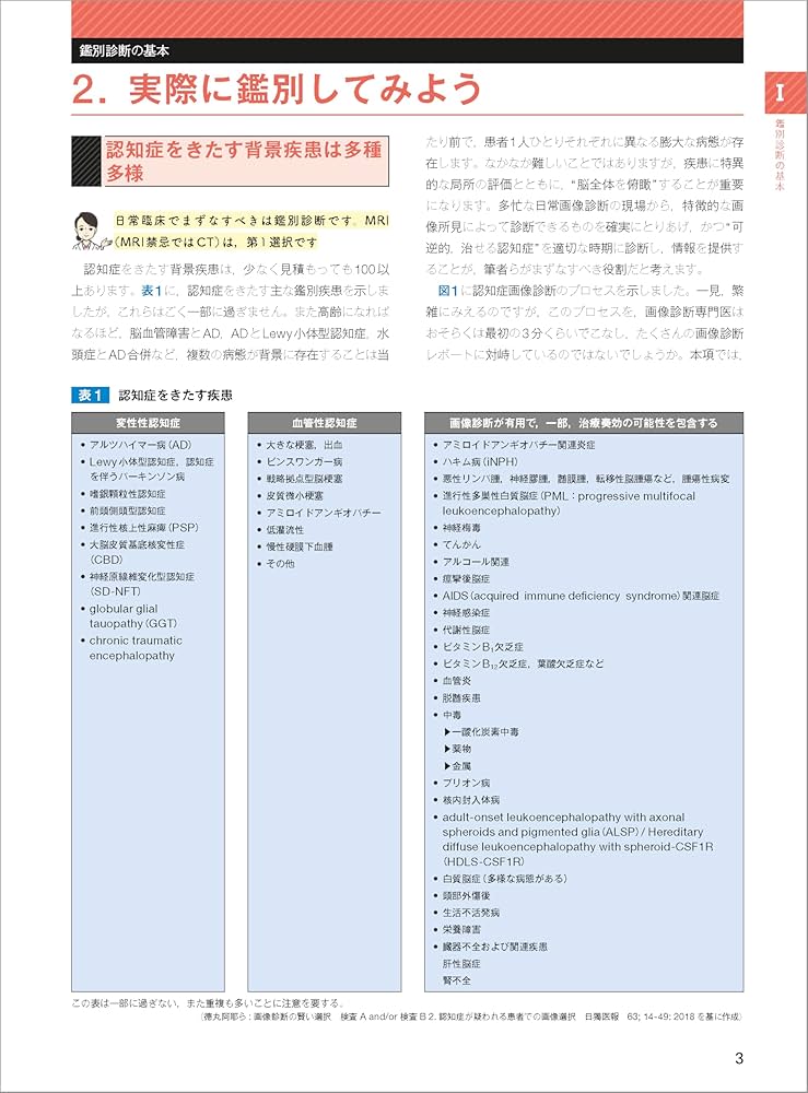画像で究める認知症 | 德丸 阿耶 |本 | 通販 | Amazon
