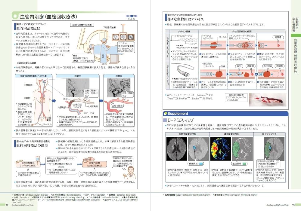 81MS5RvwspL._AC_UF1000,