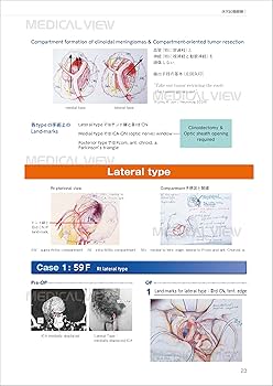エッセンシャル頭蓋底外科−イラストとビデオで学ぶ頭蓋底中心部腫瘍の