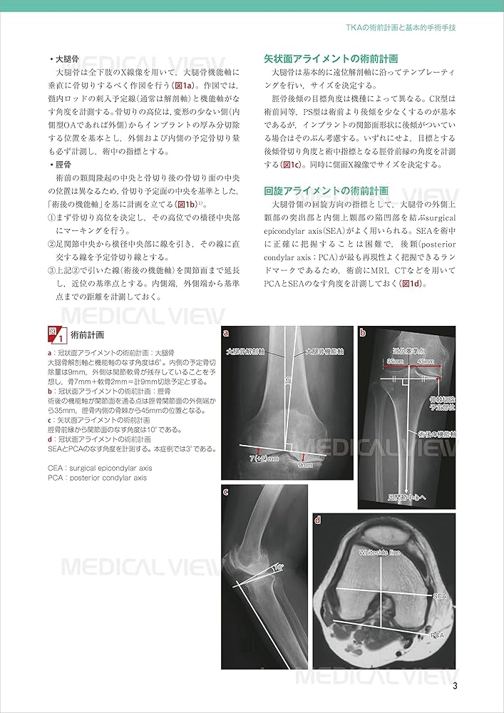 膝関節の再建手術 (新OS NEXUS No.1) | 松田 秀一 |本 | 通販 | Amazon