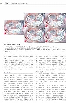 心臓手術ビデオアトラス 手術手技と画像診断［Web動画付］ | 江石清行