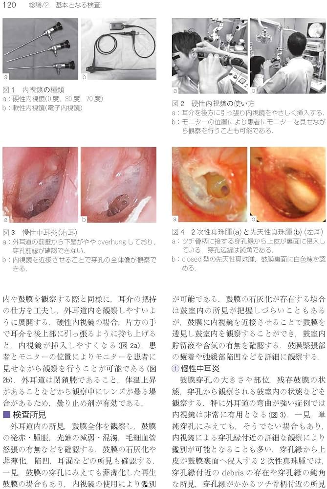 Amazon.co.jp: 今日の耳鼻咽喉科・頭頸部外科治療指針 第4版 : 森山 寛: 本