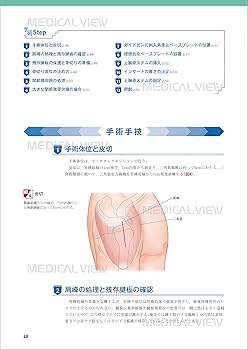 上肢の人工関節手術［Web動画付］ (新OS NEXUS No.5) | 今井 晋二 |本