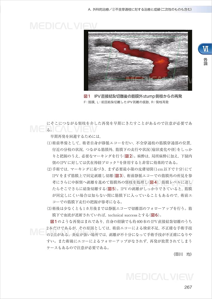 新臨床静脈学 | 日本静脈学会 |本 | 通販 | Amazon