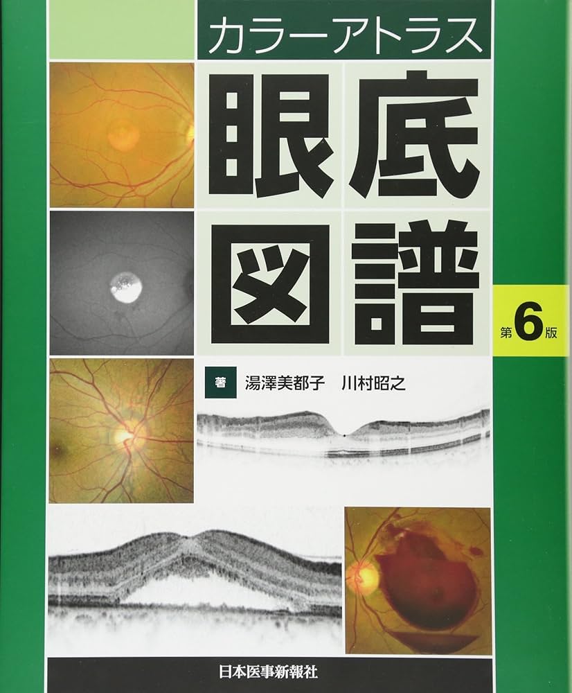 カラーアトラス 眼底図譜 | 湯澤美都子, 川村昭之 |本 | 通販 | Amazon