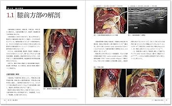 膝エコーのすべて〈解剖・診断・インターベンション〉 | 中瀬 順介