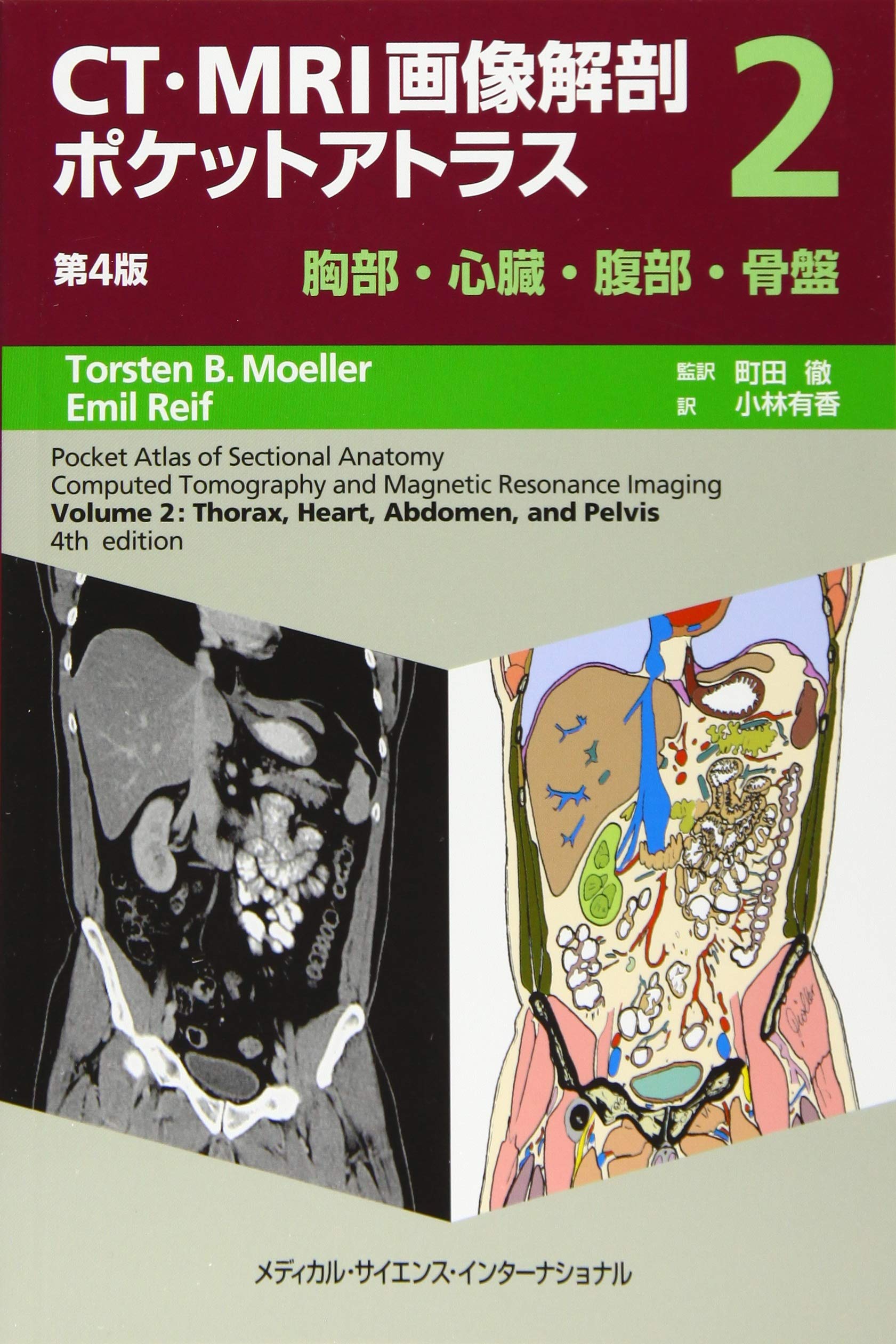 CT・MRI画像解剖ポケットアトラス 第4版 II巻 胸部・心臓・腹部・骨盤
