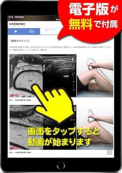 膝エコーのすべて〈解剖・診断・インターベンション〉 | 中瀬 順介
