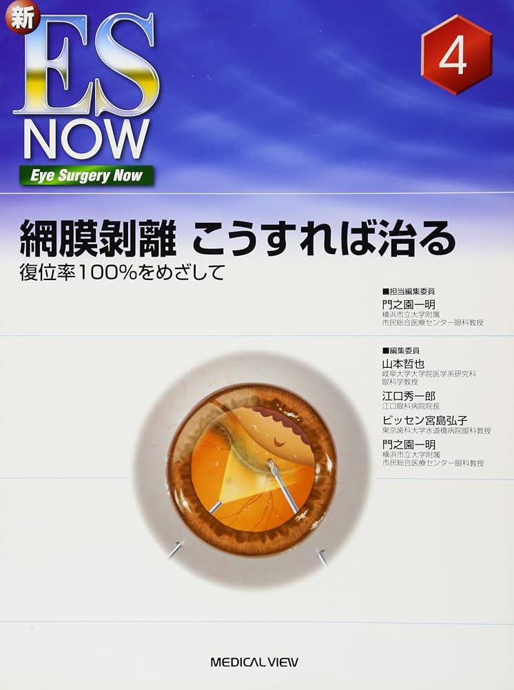 網膜剥離 こうすれば治る−復位率100%をめざして (新ES Now 4) | 門之