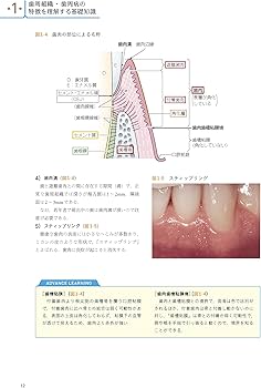 Amazon.co.jp: 歯科衛生士のための最新歯周病学 : 加藤 熈, 坂上 竜資: 本