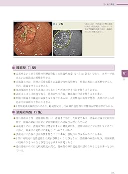 消化管内視鏡診断テキスト I 食道・胃・十二指腸 第5版 (消化器画像