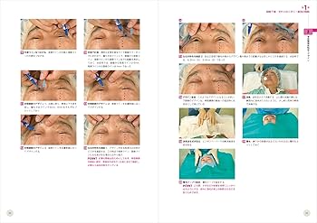 動画＆イラスト＆写真でわかる眼瞼手術の極意 advance：誰でも