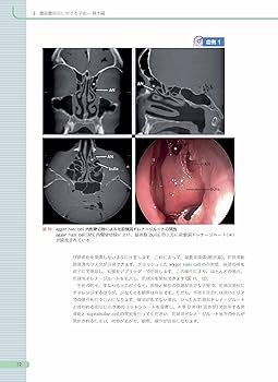 81Y04Xur-+L._AC_UF350,