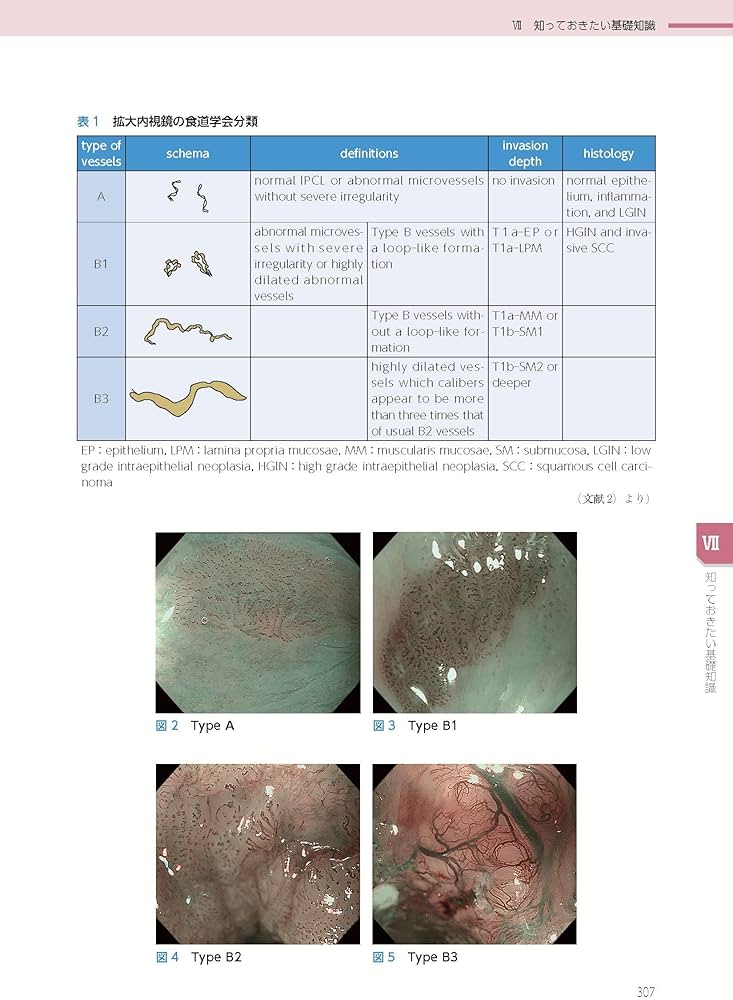 Amazon.co.jp: 消化管内視鏡診断テキスト I 食道・胃・十二指腸 第5版