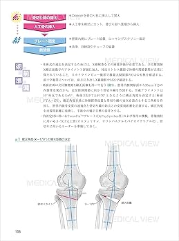 下肢 (新 執刀医のためのサージカルテクニック) | 齋藤 修 |本 | 通販