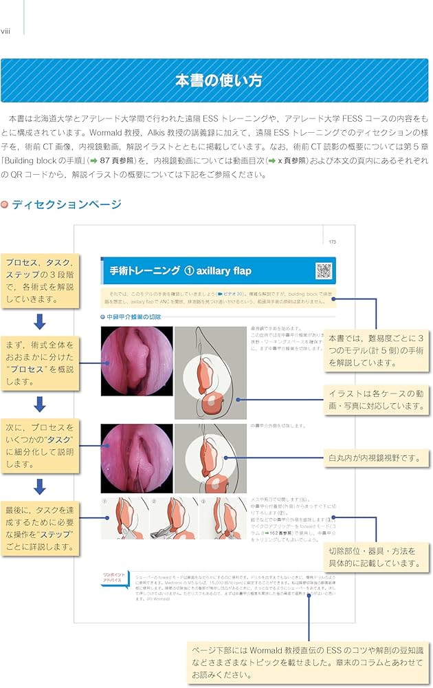 Amazon.co.jp: ウォーモルド直伝 内視鏡下鼻副鼻腔手術トレーニング