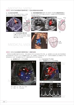 実践! 胎児超音波検査 ーどこを見て,なにを診るのか— | 辻村 久美子
