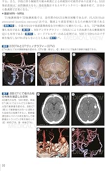 脳神経外科 周術期管理のすべて 第5版 | 松谷 雅生, 田村 晃, 藤巻