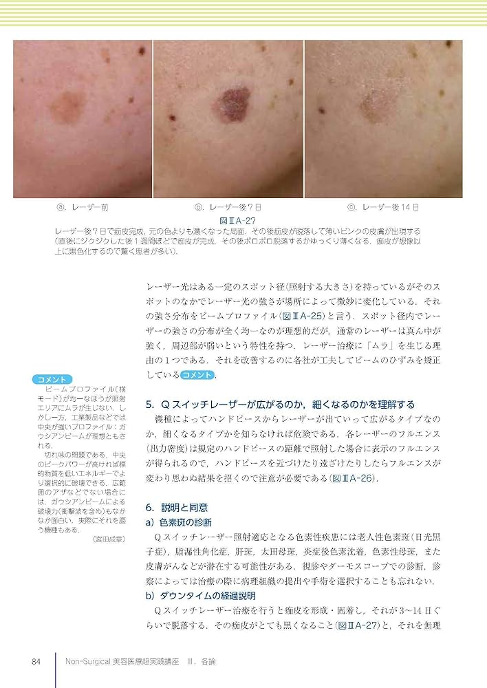 Non-Surgical美容医療超実践講座 | 宮田成章, 宮田 成章 |本 | 通販