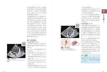 改訂2版 新生児の心エコー入門:超音波検査にもとづくNICU循環管理の