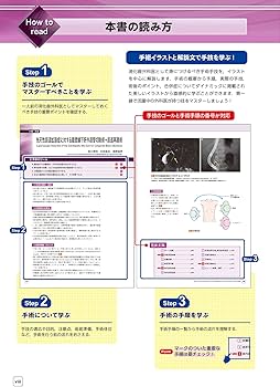 消化器腹腔鏡下手術 肝臓・胆道・膵臓・脾臓 (ビジュアルサージカル