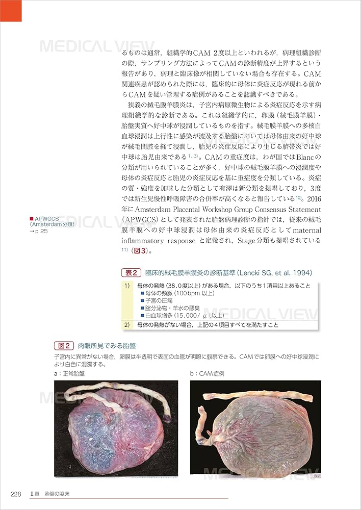 基礎と臨床の両側面からみた 胎盤学 | 日本胎盤学会 |本 | 通販 | Amazon